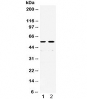 Western blot testing of human 1) SW620 and 2) A431 cell lysate with XRCC4 antibody. Predicted molecular weight: 35-38/55 kDa (unmodified/phosphorylated).