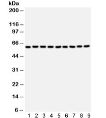 Western blot testing of 1) rat brain, 2) mouse brain, 3) rat skeletal muscle, 4) mouse skeletal muscle, human 5) U87, 6) placenta, 7) HT1080, 8) HeLa and 9) NEURO lysate with SMAD4 antibody. Expected/observed molecular weight ~60 kDa.