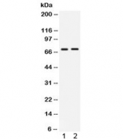 Western blot testing of human 1) HepG2 and 2) HeLa lysate with cIAP2 antibody. Predicted/observed molecular weight ~68 kDa.