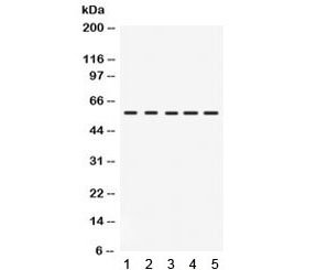 Western blot testing of 1) rat intestine, 2) human HeLa, 3) human COLO320, 4) mouse NIH3T3 and 5) mouse HEPA lysate with IRF5 antibody. Expected/observed molecular weight ~57 kDa.
