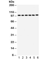 Western blot testing of 1) rat liver, 2) mouse liver, 3) human placenta, 4) HeLa, 5) SMCC and 6) HepG2 lysate with STIM1 antibody. Predicted molecular weight ~77 kDa, observed here at ~100 kDa.