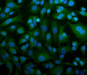 Immunofluorescent staining of FFPE human A549 cells with STIM1 antibody (green) and DAPI nuclear stain (blue). HIER: steam section in pH6 citrate buffer for 20 min.