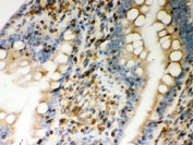 IHC testing of FFPE rat intestine with STIM1 antibody. HIER: Boil the paraffin sections in pH 6, 10mM citrate buffer for 20 minutes and allow to cool prior to staining.