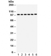 Western blot testing of 1) rat liver, 2) mouse liver, 3) human placenta, 4) HeLa, 5) SMCC and 6) HepG2 lysate with STIM1 antibody. Predicted molecular weight ~77 kDa, observed here at ~100 kDa.