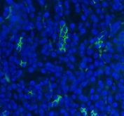 Immunofluorescent staining of FFPE mouse kidney tissue with SLC12A1 antibody (green) and DAPI nuclear stain (blue). HIER: steam section in pH8 EDTA buffer for 20 min.