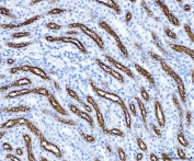 IHC testing of FFPE rat kidney tissue with SLC12A1 antibody. HIER: Boil the paraffin sections in pH8 EDTA buffer for 20 minutes and allow to cool prior to staining.