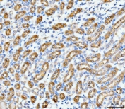 IHC testing of FFPE mouse kidney tissue with SLC12A1 antibody. HIER: Boil the paraffin sections in pH8 EDTA buffer for 20 minutes and allow to cool prior to staining.