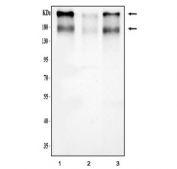Western blot testing of 1) monkey kidney, 2) rat kidney and 3) mouse kidney lysate with SLC12A1 antibody. Expected molecular weight: 121-160 kDa depending on glycosylation level. It can also be observed as an ~300 kDa complex with NKCC1.