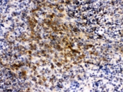 IHC testing of FFPE mouse spleen with EIF4A2 antibody. HIER: Boil the paraffin sections in pH 6, 10mM citrate buffer for 20 minutes and allow to cool prior to staining.