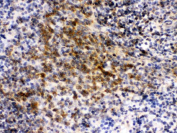 IHC staining of FFPE mouse spleen tissue with EIF4A2 antibody, HRP-secondary and DAB substrate. HIER: boil tissue sections in pH8 EDTA for 20 min and allow to cool before testing.