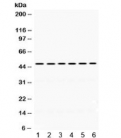 Western blot testing of rat 1) liver, 2) thymus, 3) kidney, human 4) HeLa, 5) SGC and 6) 22RV1 lysate with EIF4A2 antibody. Expected molecular weight ~46 kDa.