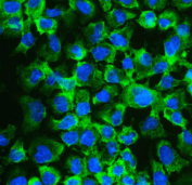 Immunofluorescent staining of FFPE human A431 cells with EIF4A2 antibody (green) and DAPI nuclear stain (blue). HIER: steam section in pH6 citrate buffer for 20 min.