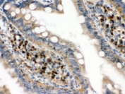 IHC testing of FFPE rat intestine with EIF4A2 antibody. HIER: Boil the paraffin sections in pH 6, 10mM citrate buffer for 20 minutes and allow to cool prior to staining.