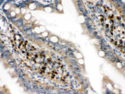 IHC staining of FFPE rat intestine tissue with EIF4A2 antibody, HRP-secondary and DAB substrate. HIER: boil tissue sections in pH8 EDTA for 20 min and allow to cool before testing.