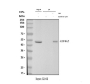 Immunoprecipitation of EIF4A2 protein from 500ug of human K562 whole cell lysate with 2ug of EIF4A2 antibody.