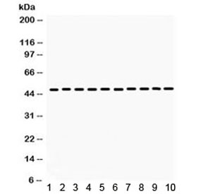 Western blot testing of 1) rat liver, 2) rat lung, 3) mouse liver, 4) mouse lung, 5) mouse testis, 6) human placenta, 7) A375, 8) HeLa, 9) 22RV1 and 10) mouse NIH3T3 lysate with Flotillin 2 antibody. Predicted molecular weight: ~47 kDa.
