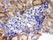 IHC testing of frozen mouse kidney tissue with Flotillin 2 antibody.