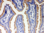 IHC testing of FFPE mouse intestine with ITPR3 antibody. HIER: Boil the paraffin sections in pH 6, 10mM citrate buffer for 20 minutes and allow to cool prior to staining.