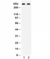 Western blot testing of 1) human HeLa and 2) SW620 lysate with ITPR3 antibody. Predicted molecular weight ~300 kDa.