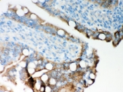 IHC testing of FFPE rat intestine with ITPR3 antibody. HIER: Boil the paraffin sections in pH 6, 10mM citrate buffer for 20 minutes and allow to cool prior to staining.