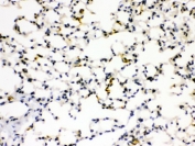 IHC testing of FFPE mouse lung tissue with RAGE antibody. HIER: Boil the paraffin sections in pH 6, 10mM citrate buffer for 20 minutes and allow to cool prior to staining.