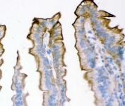 IHC testing of FFPE mouse intestine with Plectin antibody. HIER: Boil the paraffin sections in pH8 EDTA buffer for 20 minutes and allow to cool prior to staining.
