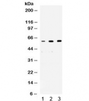 Western blot testing of 1) rat brain, 2) human placenta and 3) human PANC lysate with p54nrb antibody. Predicted molecular weight ~54 kDa.