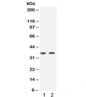 Western blot testing of 1) MCF7 and 2) 22RV1 lysate with SIX1 antibody. Predicted molecular weight ~32 kDa.