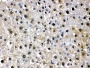 IHC testing of FFPE mouse liver with DDB1 antibody. HIER: Boil the paraffin sections in pH 6, 10mM citrate buffer for 20 minutes and allow to cool prior to staining.