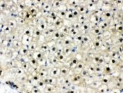 IHC testing of FFPE rat liver with DDB1 antibody. HIER: Boil the paraffin sections in pH 6, 10mM citrate buffer for 20 minutes and allow to cool prior to staining.