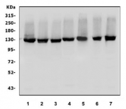 Western blot testing of human 1) HeLa, 2) HepG2, 3) HEK293, 4) K562 5) Raji, 6) Caco-2 and 7) ThP-1 cell lysate with DDB1 antibody. Predicted molecular weight ~127 kDa.