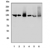 Western blot testing of 1) rat brain, 2) rat kidney, 3) rat C6, 4) mouse brain, 5) mouse kidney and 6) mouse testis tissue lysate with DDB1 antibody. Predicted molecular weight ~127 kDa.