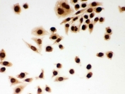 ICC testing of FFPE human SMMC-7721 cells with DDB1 antibody. HIER: Boil the paraffin sections in pH 6, 10mM citrate buffer for 20 minutes and allow to cool prior to staining.