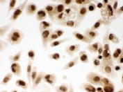 ICC testing of FFPE human PC-3 cells with DDB1 antibody. HIER: Boil the paraffin sections in pH 6, 10mM citrate buffer for 20 minutes and allow to cool prior to staining.
