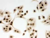ICC testing of FFPE human A549 cells with DDB1 antibody. HIER: Boil the paraffin sections in pH 6, 10mM citrate buffer for 20 minutes and allow to cool prior to staining.