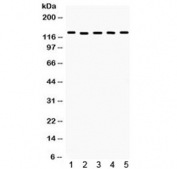 Western blot testing of 1) rat brain, 2) rat liver, 3) mouse ovary, 4) mouse testis and 5) human MCF7 lysate. Predicted/observed molecular weight ~127 kDa.