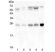 Western blot testing of 1) rat skeletal muscle, 2) rat lung, 3) mouse heart, 4) mouse skeletal muscle and 5) mouse lung lysate with BAK antibody. Expected molecular weight ~23 kDa.