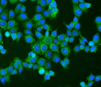 Immunofluorescent staining of FFPE human MCF7 cells with BAK antibody (green) and DAPI nuclear stain (blue). HIER: steam section in pH6 citrate buffer for 20 min.