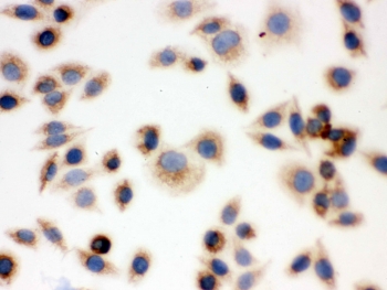 ICC testing of FFPE human SMMC-7721 cells with BAK antibody. HIER: Boil the paraffin sections in pH 6, 10mM citrate buffer for 20 minutes and allow to cool prior to staining.