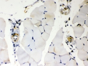IHC testing of FFPE mouse skeletal muscle with BAK antibody. HIER: Boil the paraffin sections in pH 6, 10mM citrate buffer for 20 minutes and allow to cool prior to staining.