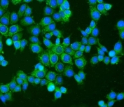 Immunofluorescent staining of FFPE human MCF7 cells with BAK antibody (green) and DAPI nuclear stain (blue). HIER: steam section in pH6 citrate buffer for 20 min.