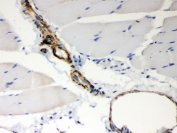 IHC testing of FFPE rat skeletal muscle with BAK antibody. HIER: Boil the paraffin sections in pH 6, 10mM citrate buffer for 20 minutes and allow to cool prior to staining.