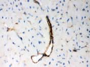 IHC testing of frozen mouse heart tissue with BAK antibody. HIER: Boil the paraffin sections in pH 6, 10mM citrate buffer for 20 minutes and allow to cool prior to staining.