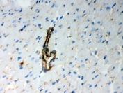 IHC testing of frozen rat heart tissue with BAK antibody. HIER: Boil the paraffin sections in pH 6, 10mM citrate buffer for 20 minutes and allow to cool prior to staining.