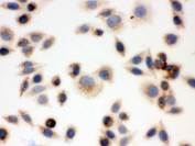 ICC testing of FFPE human SMMC-7721 cells with BAK antibody. HIER: Boil the paraffin sections in pH 6, 10mM citrate buffer for 20 minutes and allow to cool prior to staining.