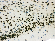 IHC testing of FFPE mouse brain with SMN1/2 antibody. HIER: Boil the paraffin sections in pH 6, 10mM citrate buffer for 20 minutes and allow to cool prior to staining.