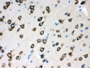 IHC testing of FFPE rat brain with SMN1/2 antibody. HIER: Boil the paraffin sections in pH 6, 10mM citrate buffer for 20 minutes and allow to cool prior to staining.