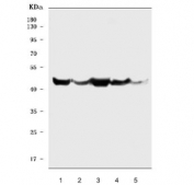 Western blot testing of 1) human HepG2, 2) human HeLa, 3) human A549, 4) rat skeletal muscle and 5) rat heart tissue lysate with PDK4 antibody. Expected molecular weight ~46 kDa.
