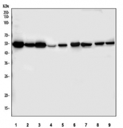 Western blot testing of 1) human SH-SY5Y, 2) human HeLa, 3) human K562, 4) human A549, 5) human HepG2, 6) human PC-3, 7) rat brain, 8) mouse brain and 9) mouse NIH 3T3 cell lysate with Fascin antibody. Predicted molecular weight ~55 kDa.