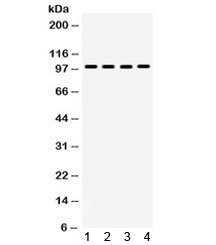 Western blot testing of 1) rat brain, 2) rat skeletal muscle, 3) human PANC and 4) mouse NIH3T3 lysate with MAPK6 antibody. Predicted molecular weight ~83 kDa but routinely observed at ~97 kDa.~